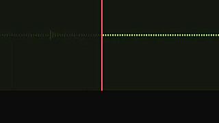 Incredible Audio Recording of Neighbor's Activities Part 1