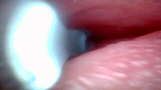 Endoscope Camera Records Male Ejaculation in Outdoor Hospital Setting