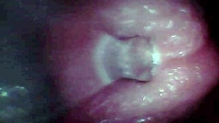 Endoscope Camera Records Male Ejaculation in Outdoor Hospital Setting