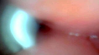 Endoscope Camera Records Male Ejaculation in Outdoor Hospital Setting