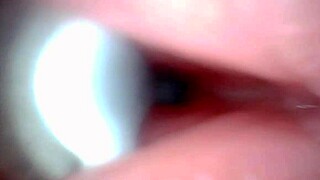 Endoscope Camera Records Male Ejaculation in Outdoor Hospital Setting