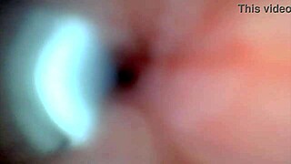 Endoscope Camera Records Male Ejaculation in Outdoor Hospital Setting