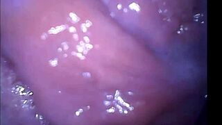 Girl Cums Filmed From Inside A Vagina At Secretfriends Com