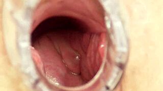 Sexy Milf In Nurse Uniform Performs Bizarre Self Exam