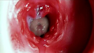 Watch her anus explode in orgasm with massive sperm load