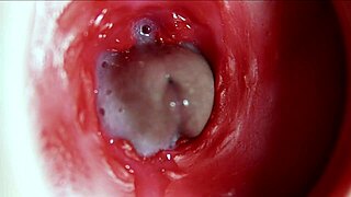 Watch her anus explode in orgasm with massive sperm load