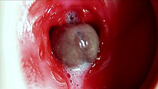 Watch her anus explode in orgasm with massive sperm load